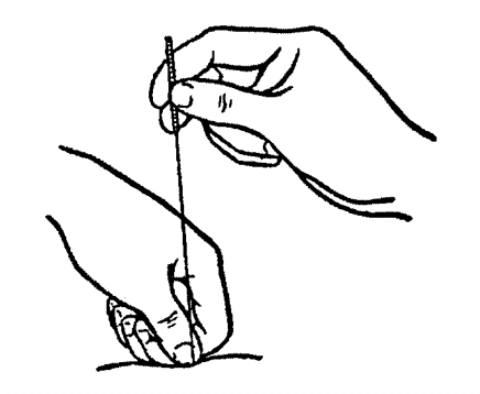 Пальцы колет иголками. Держит иголку. Иглорефлексотерапия методы введения игл. Методика введения иглы при иглоукалывании.